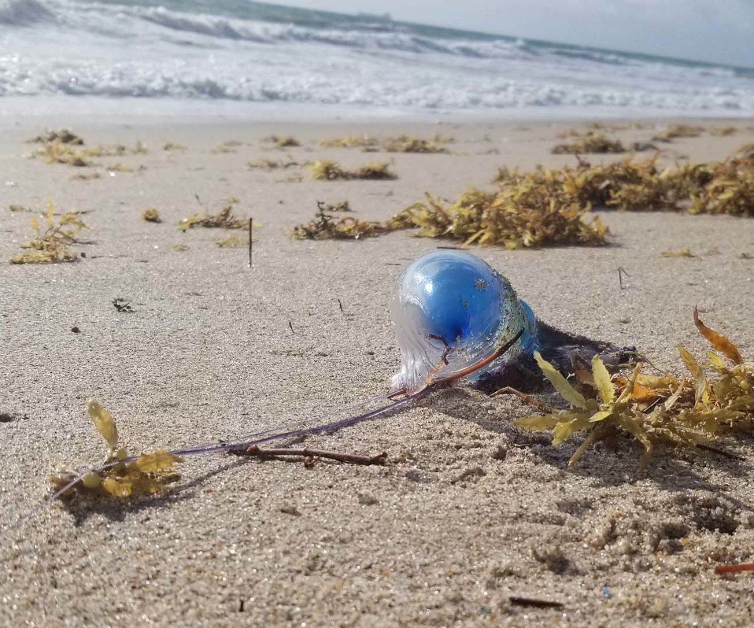 sea lice bite remedy jelly fish sting cure